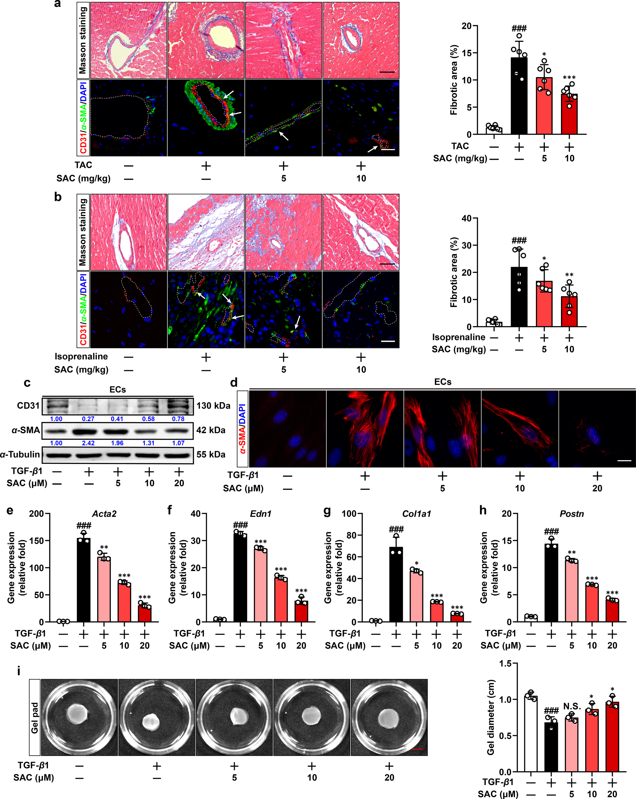 Suppression of PFKFB3-driven glycolysis restrains  endothelial-to-mesenchymal transition and fibrotic response | Signal  Transduction and Targeted Therapy