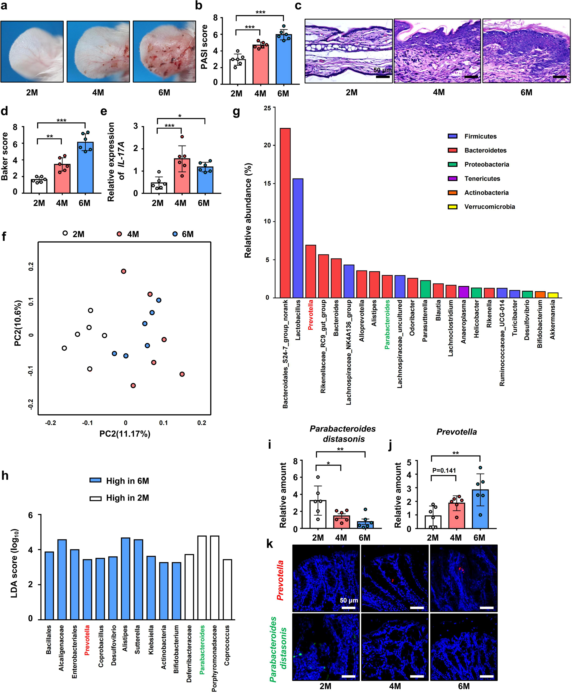 Intestinal dysbiosis exacerbates the pathogenesis of psoriasis-like  phenotype through changes in fatty acid metabolism | Signal Transduction  and Targeted Therapy