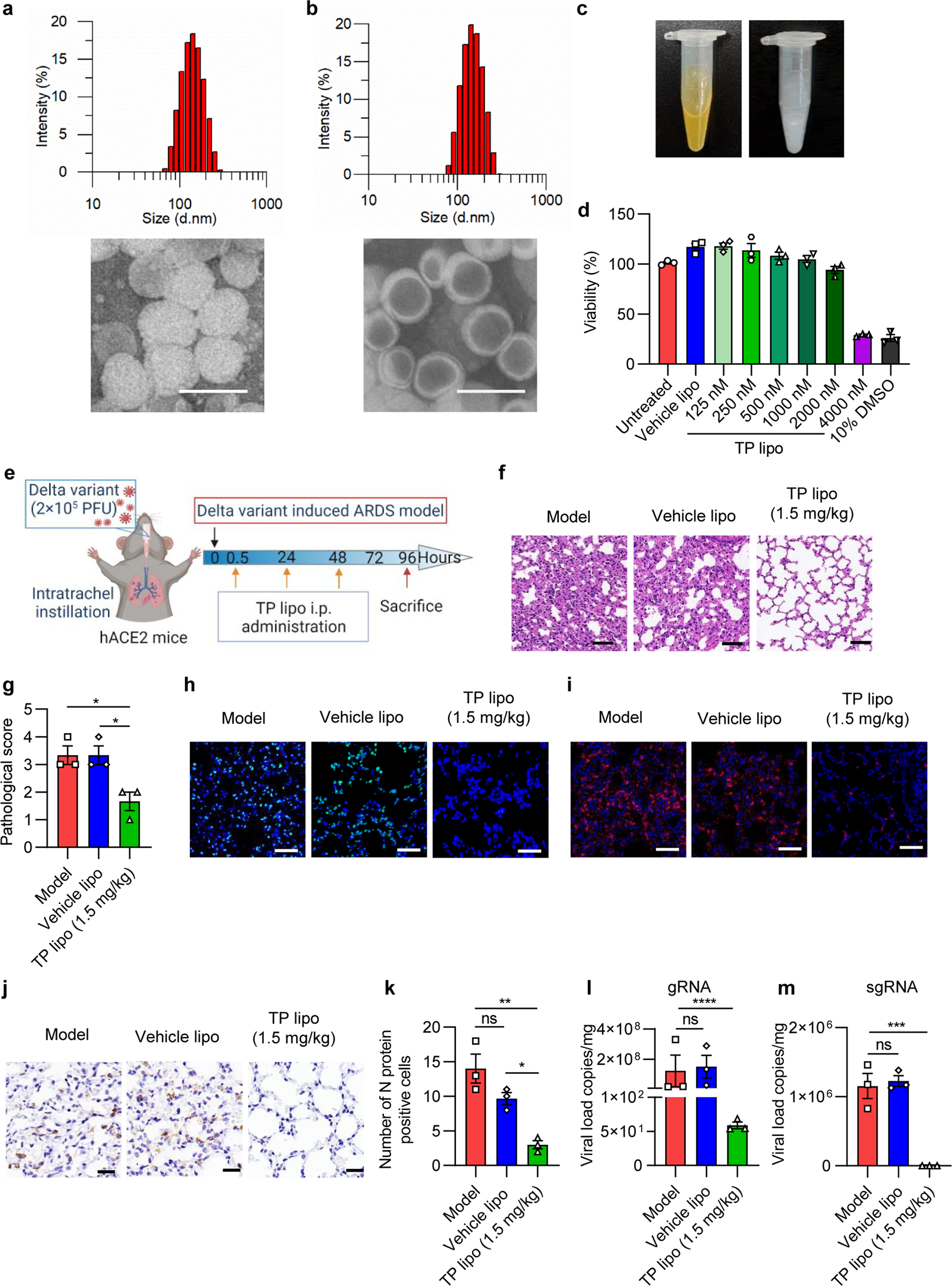 Tripterin liposome relieves severe acute respiratory syndrome as a potent  COVID-19 treatment | Signal Transduction and Targeted Therapy