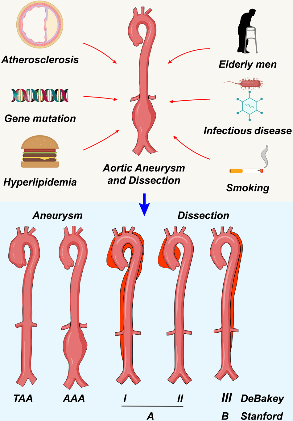 The mechanism and therapy of aortic aneurysms Signal Transduction and Targeted Therapy pic