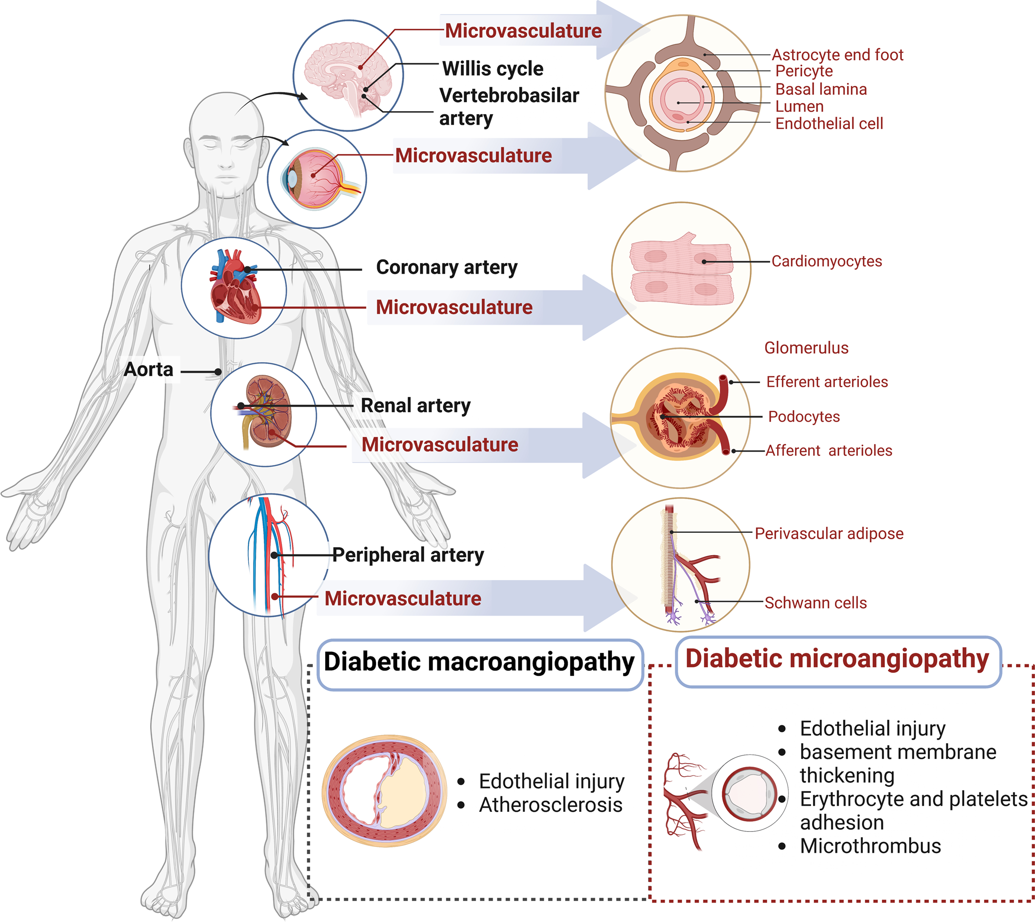 Diabetic vascular diseases: molecular mechanisms and therapeutic strategies  | Signal Transduction and Targeted Therapy