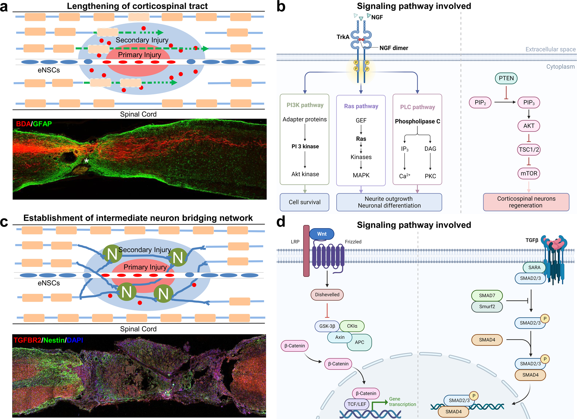 Spinal cord injury: molecular mechanisms and therapeutic interventions |  Signal Transduction and Targeted Therapy