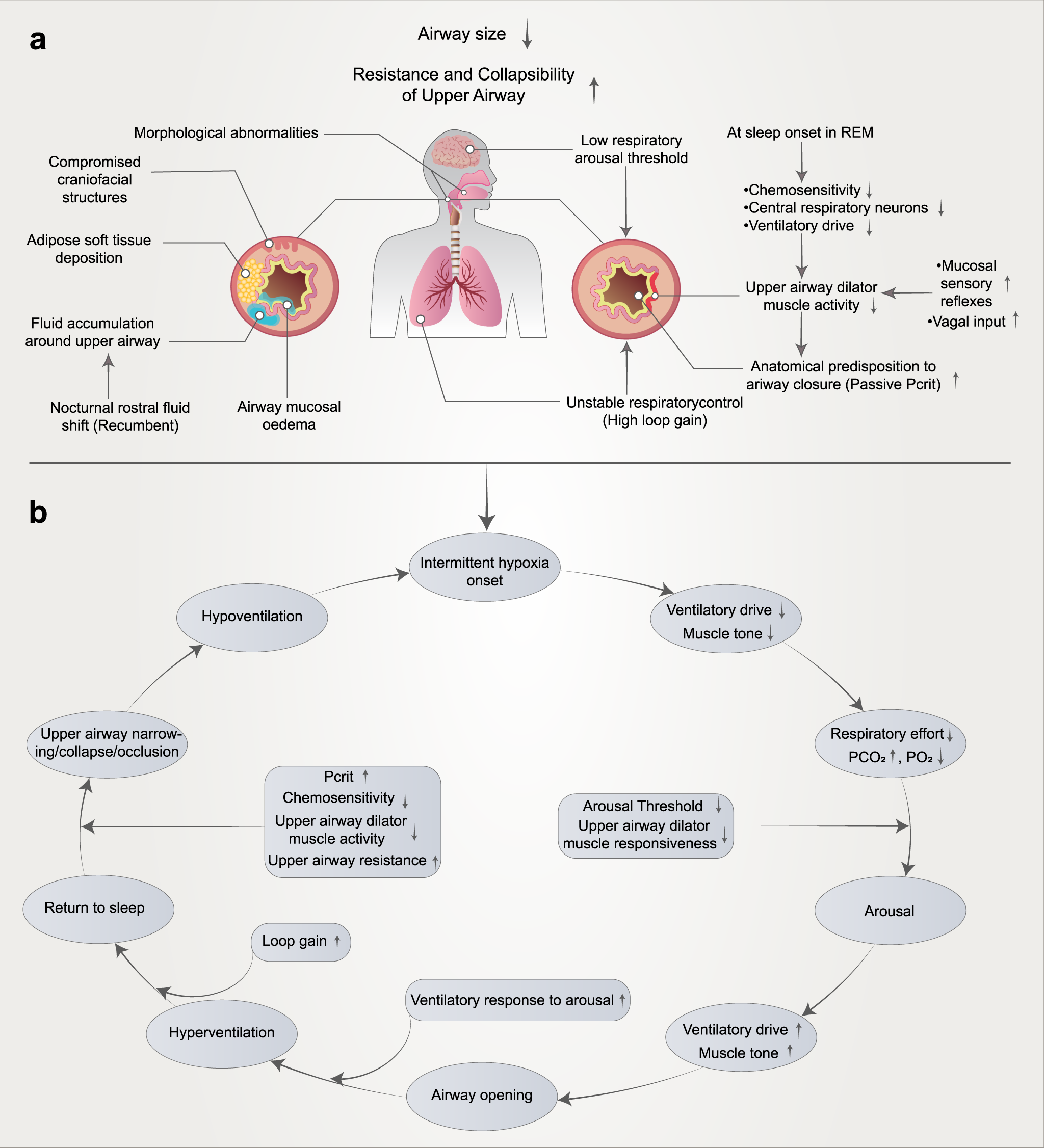 Pathophysiological mechanisms and therapeutic approaches in obstructive sleep apnea syndrome Signal Transduction and Targeted Therapy pic picture