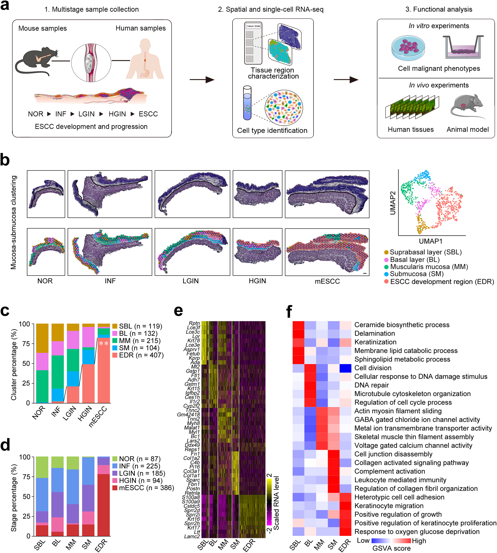 Aberrant epithelial cell interaction promotes esophageal squamous-cell  carcinoma development and progression | Signal Transduction and Targeted  Therapy