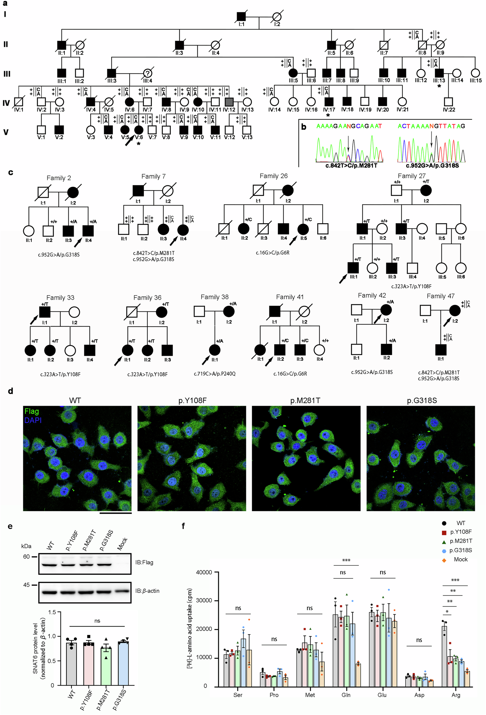 Loss-of-function variations in solute carrier family 38 member 6 are  associated with essential tremor | Signal Transduction and Targeted Therapy