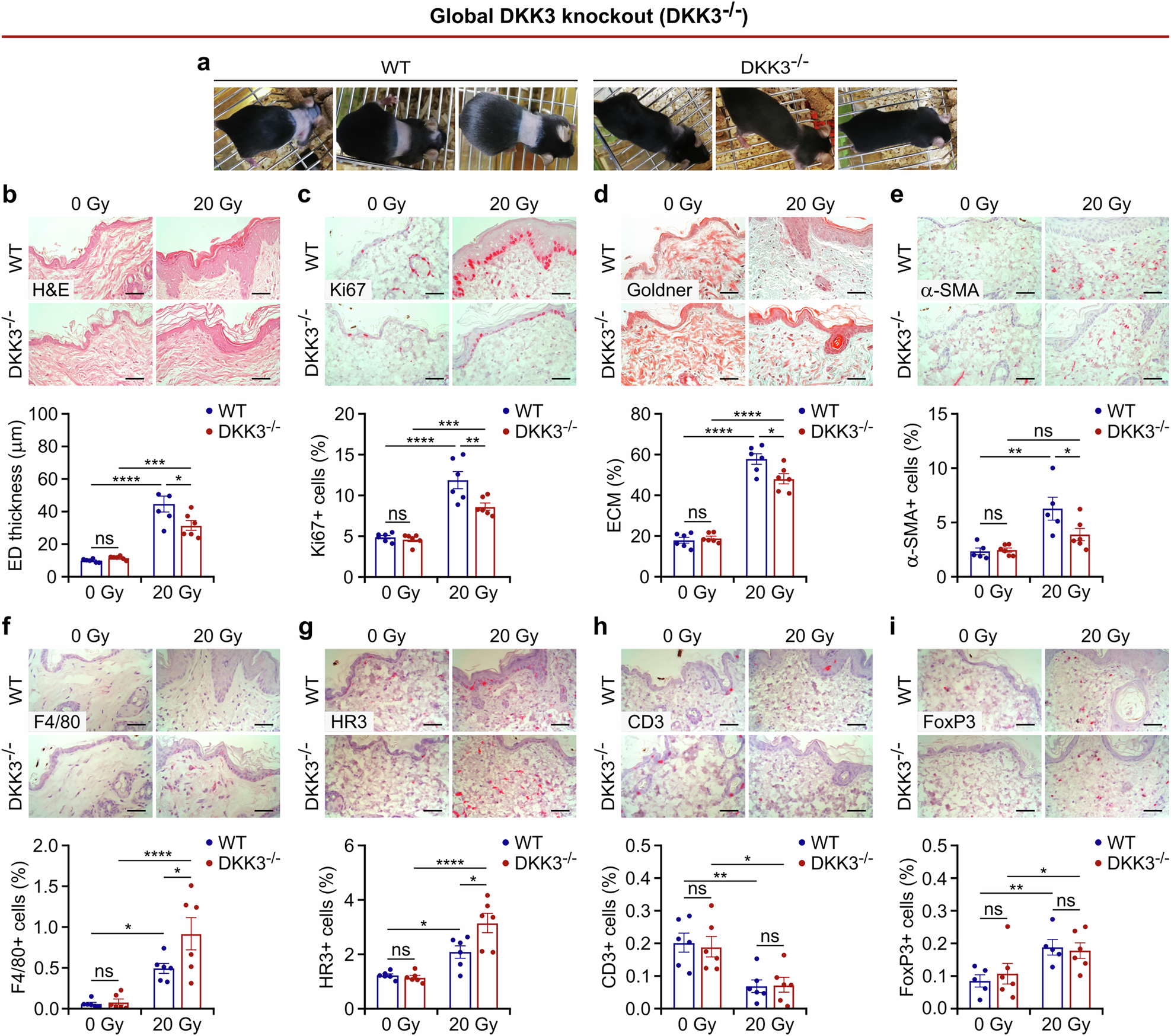放射線治療後の皮膚損傷を引き起こすタンパク質を特定 (Protein identified as cause of skin damage after radiotherapy)