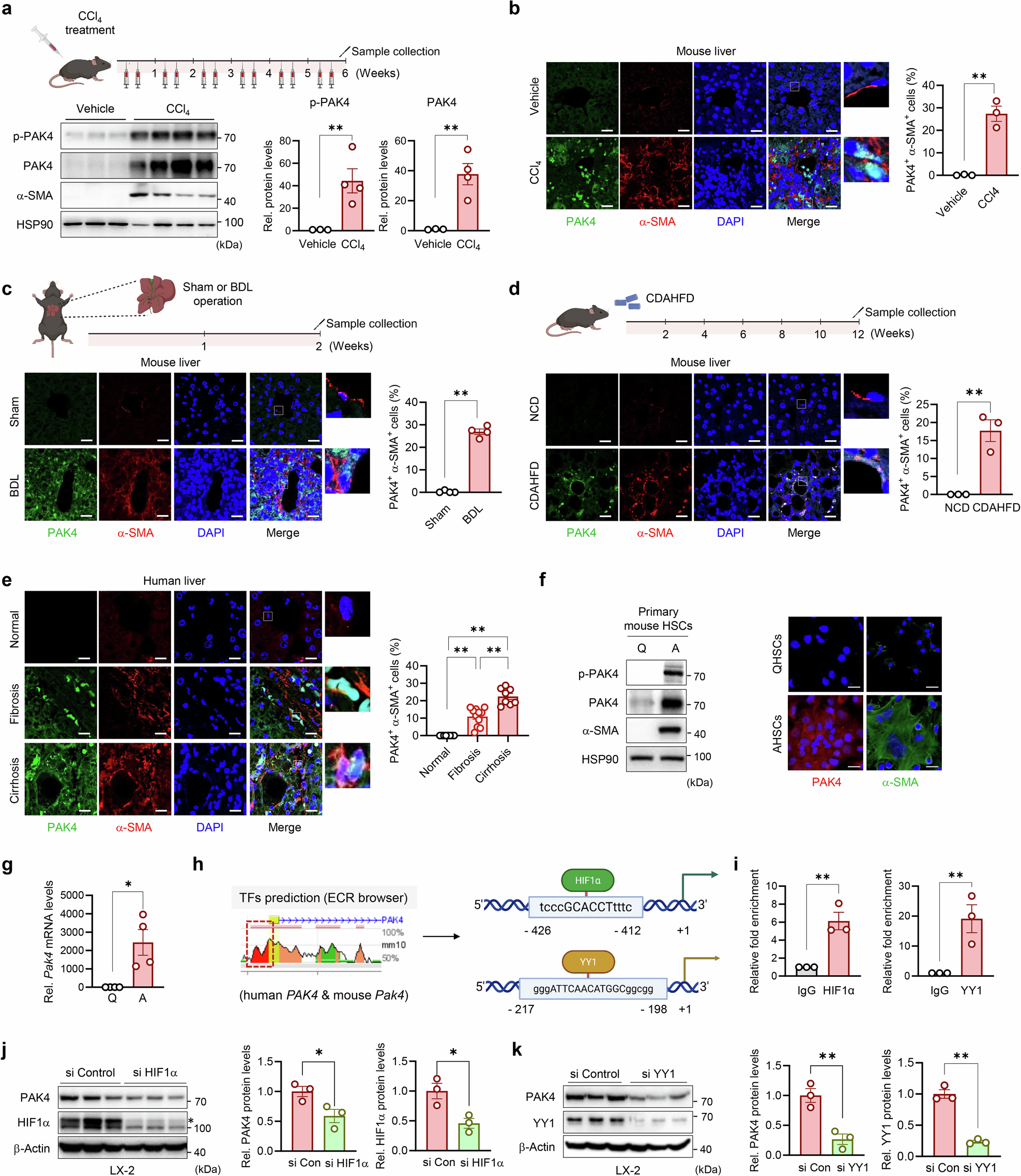 p21-activated kinase 4 drives hepatic stellate cell activation and liver fibrosis through the phosphorylation of YAP at T428