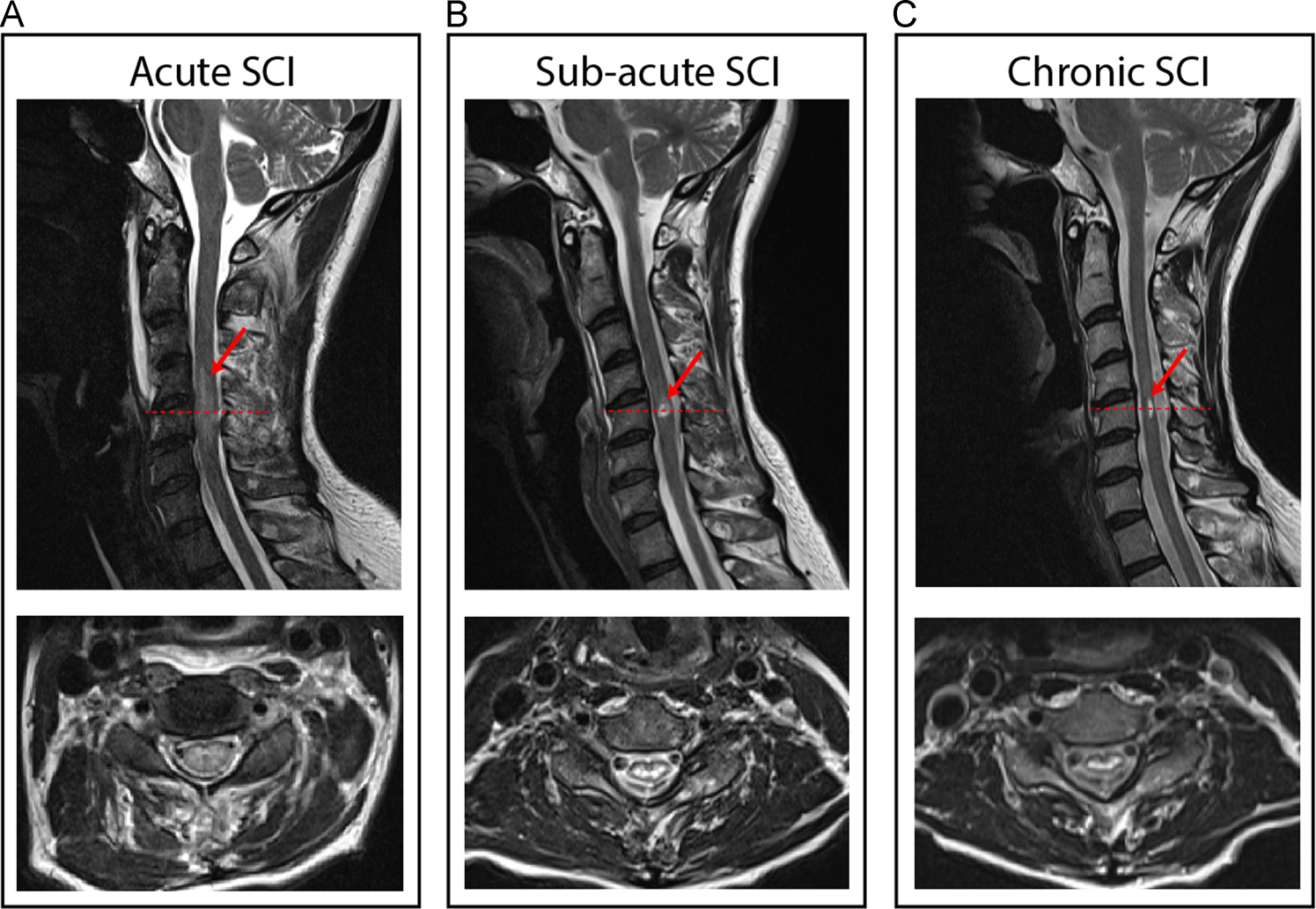 Guidelines for the conduct of clinical trials in spinal cord injury:  Neuroimaging biomarkers | Spinal Cord