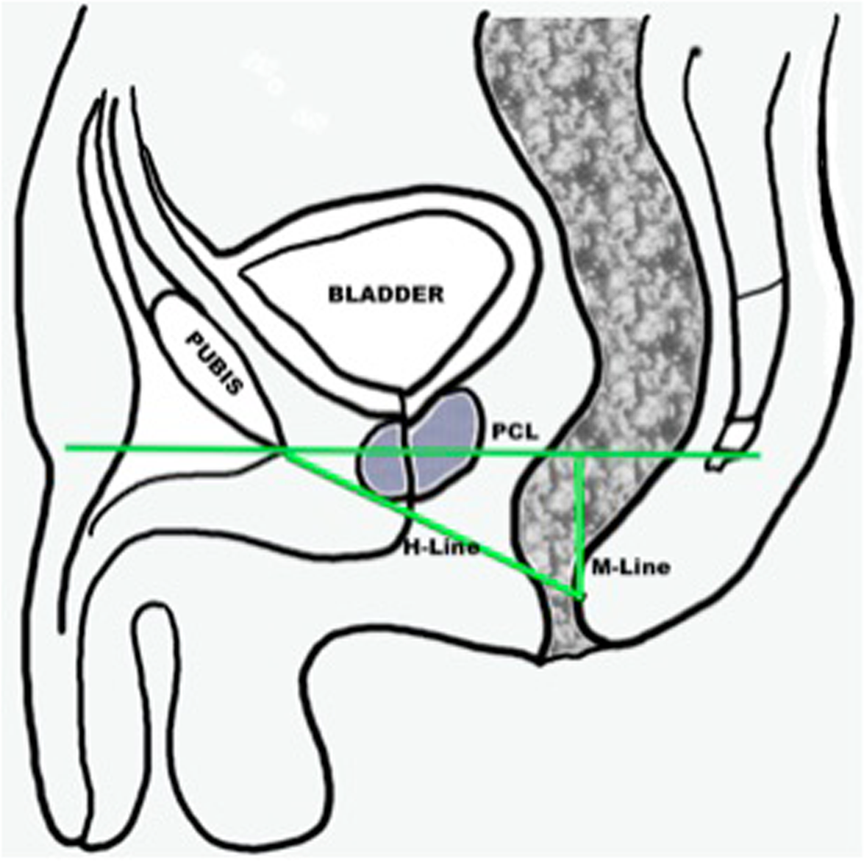Mr Defecography Detects Pelvic Floor Dysfunction In Participants