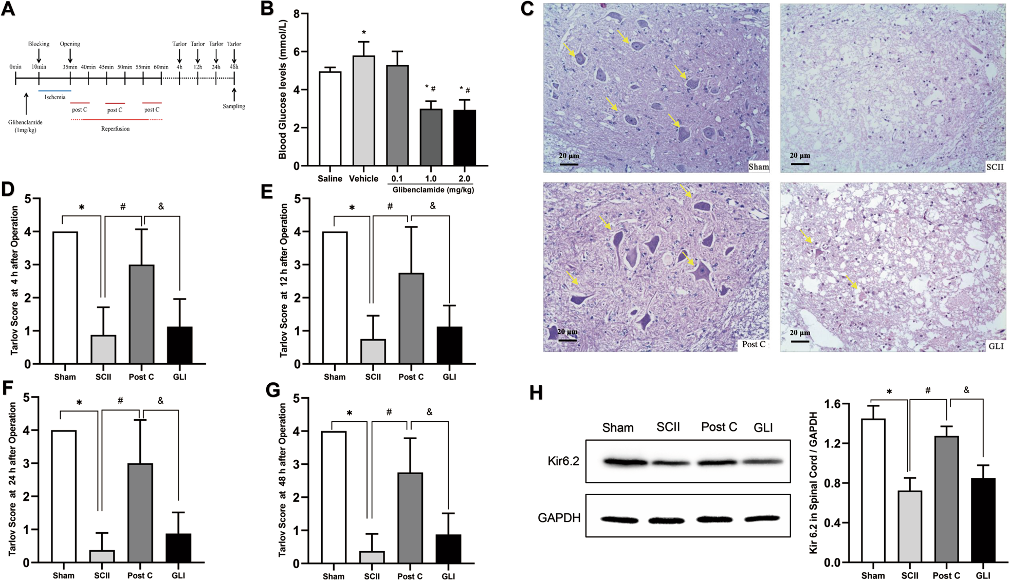 Ischemic postconditioning reduces spinal cord ischemia-reperfusion injury  through ATP-sensitive potassium channel | Spinal Cord