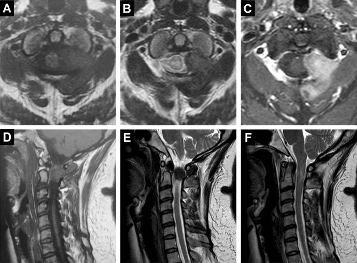 Giant cell tumour of bone around the knee: a systematic review of the  functional and oncological outcomes in: EFORT Open Reviews Volume 6 Issue 8  (2021), image size:1496x1101