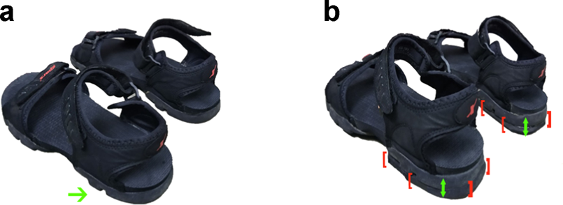 Heel lift improves walking ability of persons with traumatic cauda equina  syndrome—a pilot experimental study | Spinal Cord Series and Cases