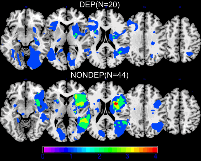 Fig. 1: Lesion overlap