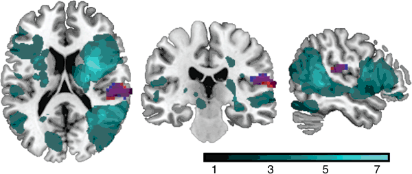Fig. 2: Main results