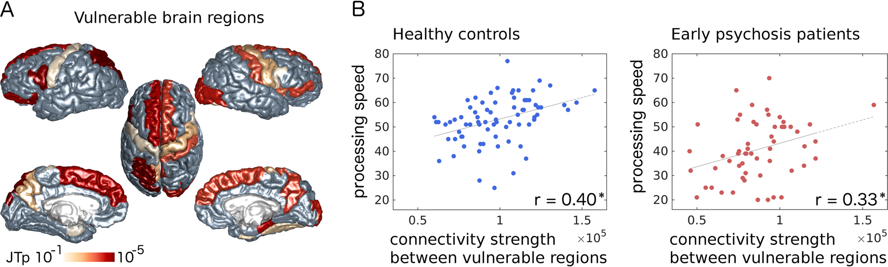 Fig. 3: Connectivity strength between vulnerable brain regions selectively correlates with processing speed.