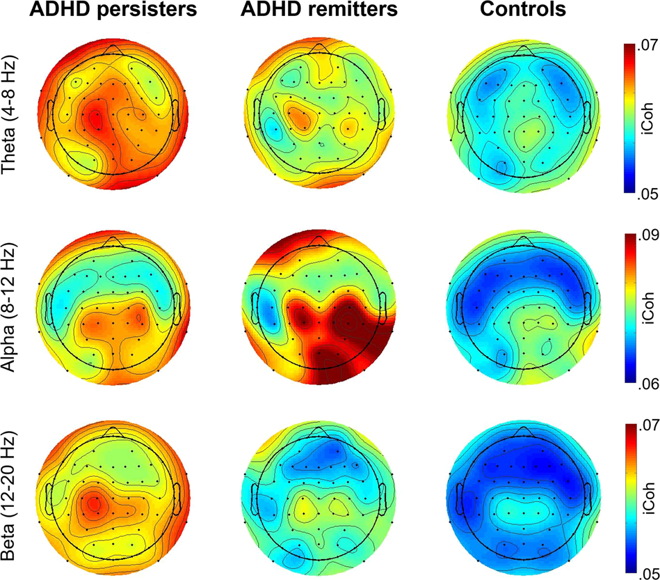 Atypical functional connectivity in adolescents and adults with persistent  and remitted ADHD during a cognitive control task | Translational Psychiatry