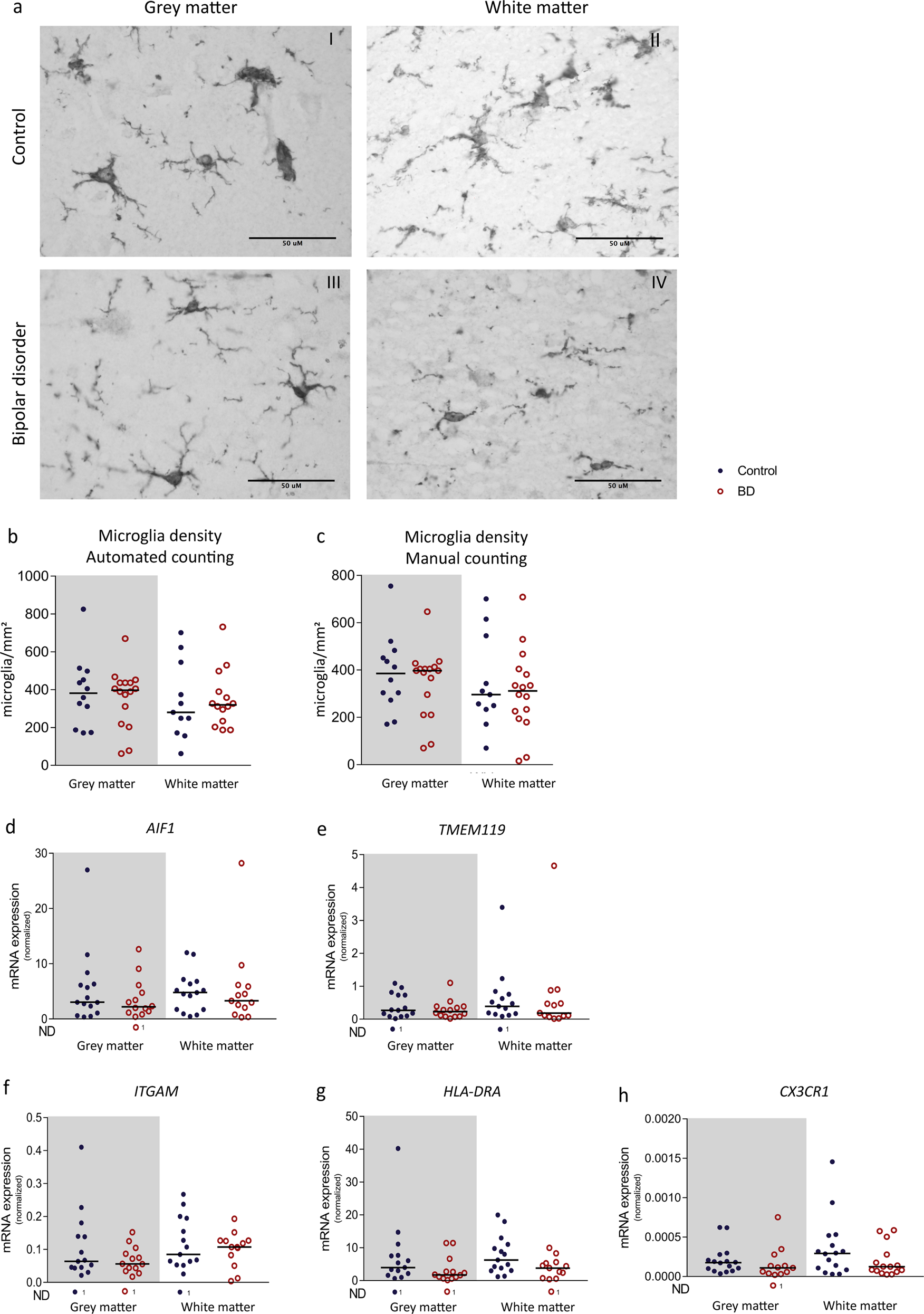 Five Ways In Which Postmortem Brain >> Microglia In Post Mortem Brain Tissue Of Patients With Bipolar Five Ways In Which Postmortem Brain >> Microglia In Post Mortem Brain Tissue Of Patients With Bipolar