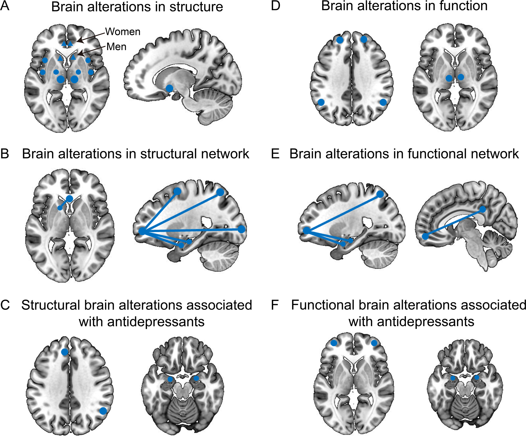 The rise and fall of MRI studies in major depressive disorder |  Translational Psychiatry