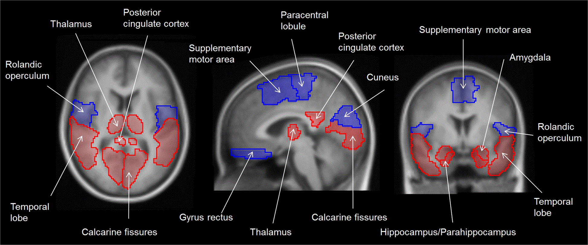 human brain mapping manuscript revision