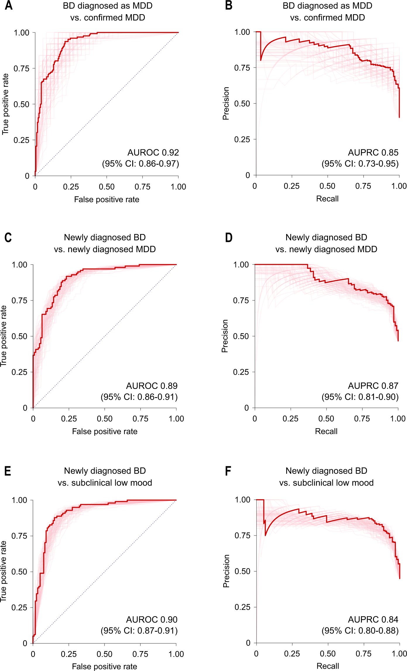 Fig. 2: Receiver operating characteristic and precision-recall curves for prediction of bipolar disorder diagnosis.