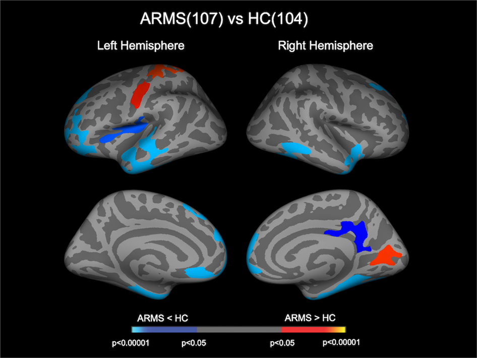 Reduced cortical thickness of the paracentral lobule in at-risk mental  state individuals with poor 1-year functional outcomes | Translational  Psychiatry