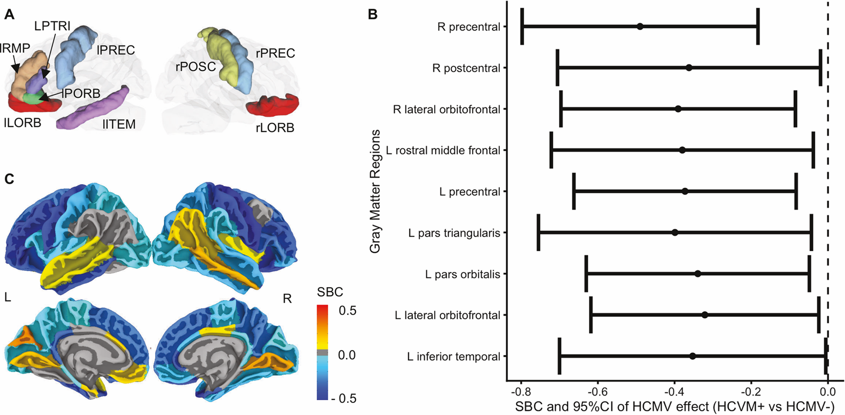 Få Skifte tøj mærke Association between cytomegalovirus infection, reduced gray matter volume,  and resting-state functional hypoconnectivity in major depressive disorder:  a replication and extension | Translational Psychiatry