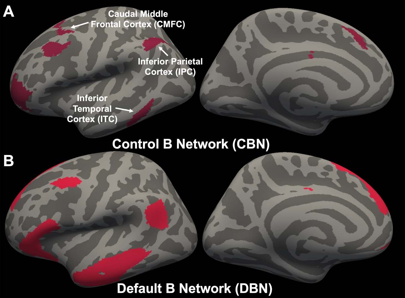 Network-wise surface-based morphometric insight into the cortical neural  circuitry underlying irritability in adolescents | Translational Psychiatry