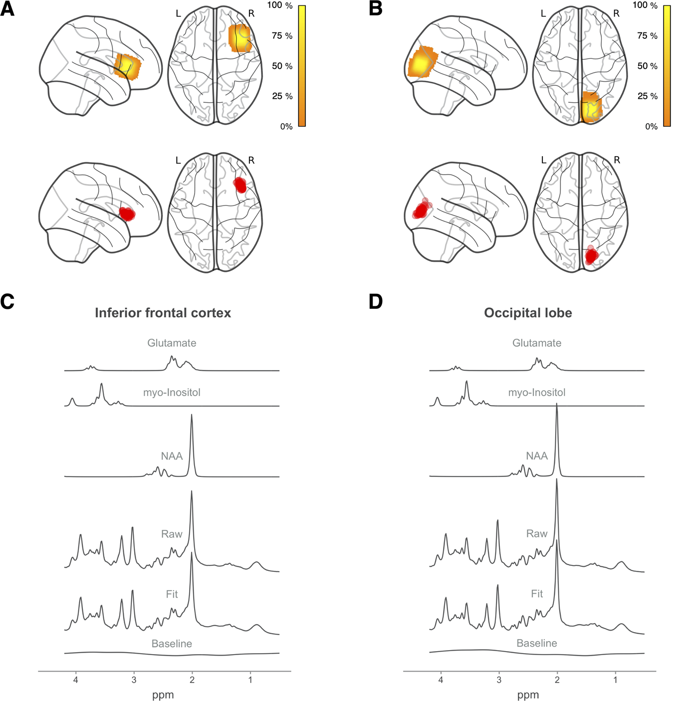 Characterizing cerebral metabolite profiles in anorexia and bulimia nervosa  and their associations with habitual behavior | Translational Psychiatry