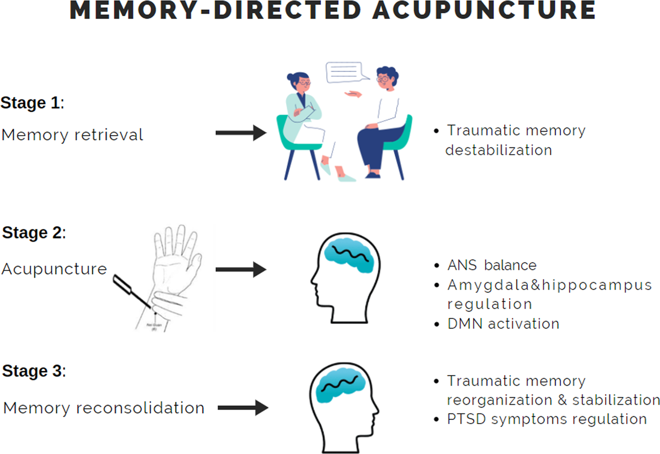 Brain stimulation may help TBI patients with memory recall