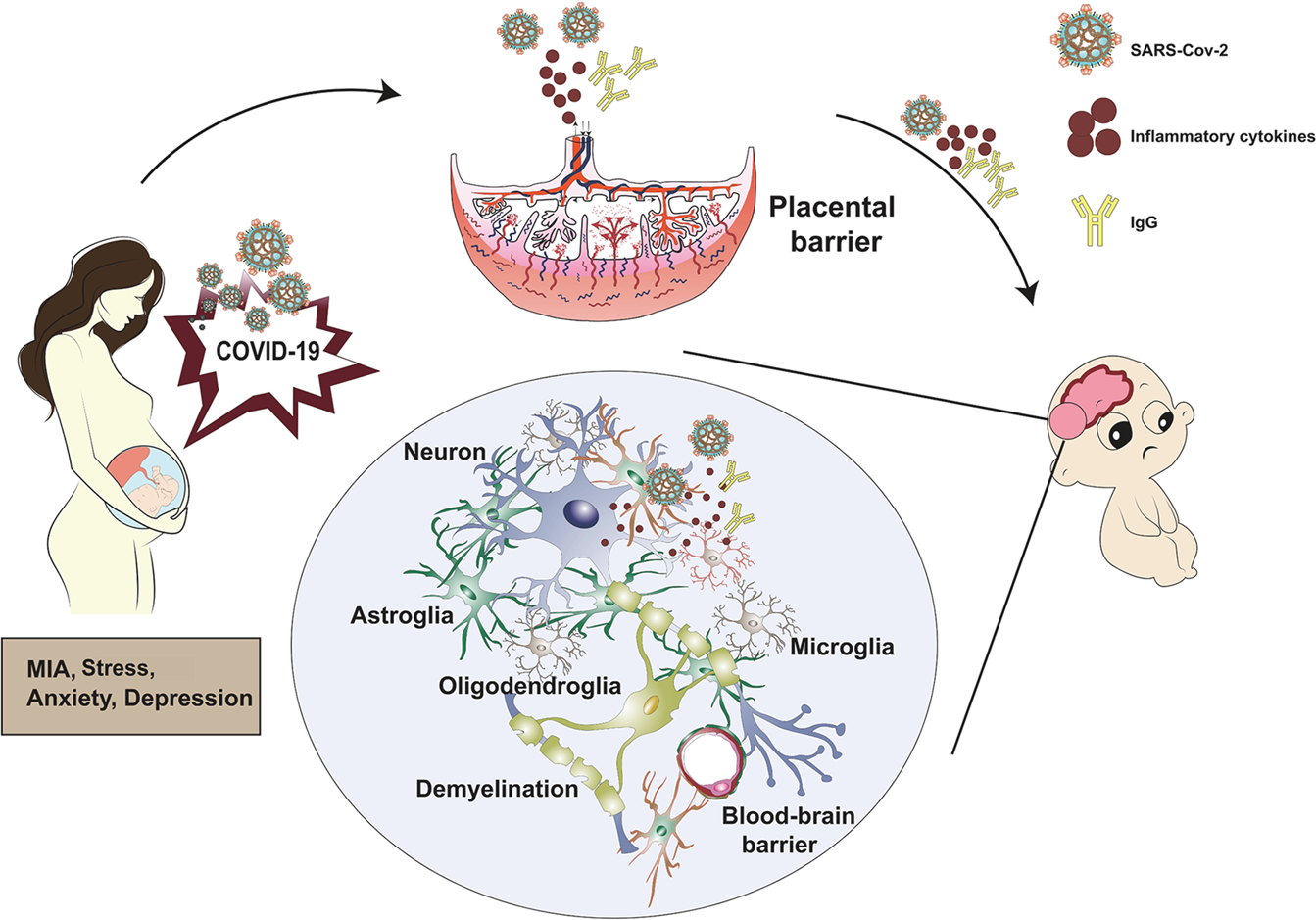 COVID-19 in pregnancy: implications for fetal brain development