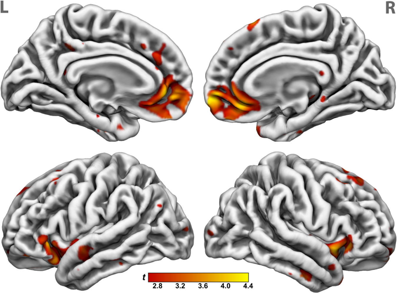 Video activation of prefrontal cortex in a consuming person during