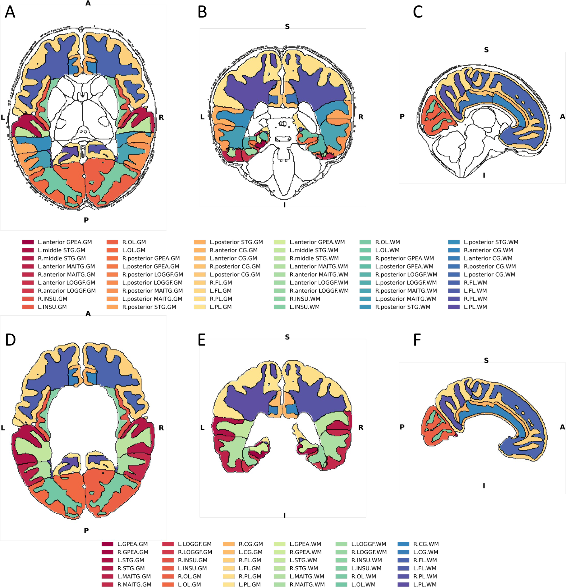 Large-scale analysis of structural brain asymmetries in schizophrenia via  the ENIGMA consortium