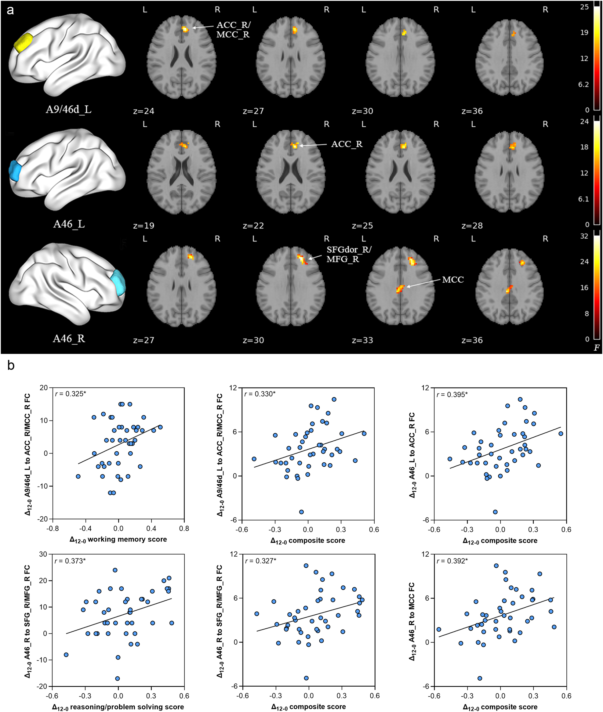 Fig. 4: Longitudinal changes of ROI-based voxel-wise FC in the antipsychotics plus metformin group compared with the antipsychotics alone group over 12 weeks and correlations with MCCB composite score.