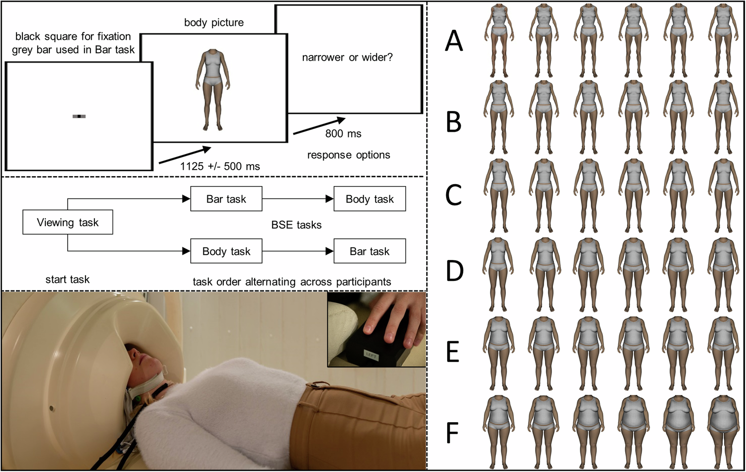 Visual body size estimation in adolescent anorexia nervosa: Behavioural and  neurophysiological data suggest intact visual perception and biased  emotional attention | Translational Psychiatry, image size:1500x949