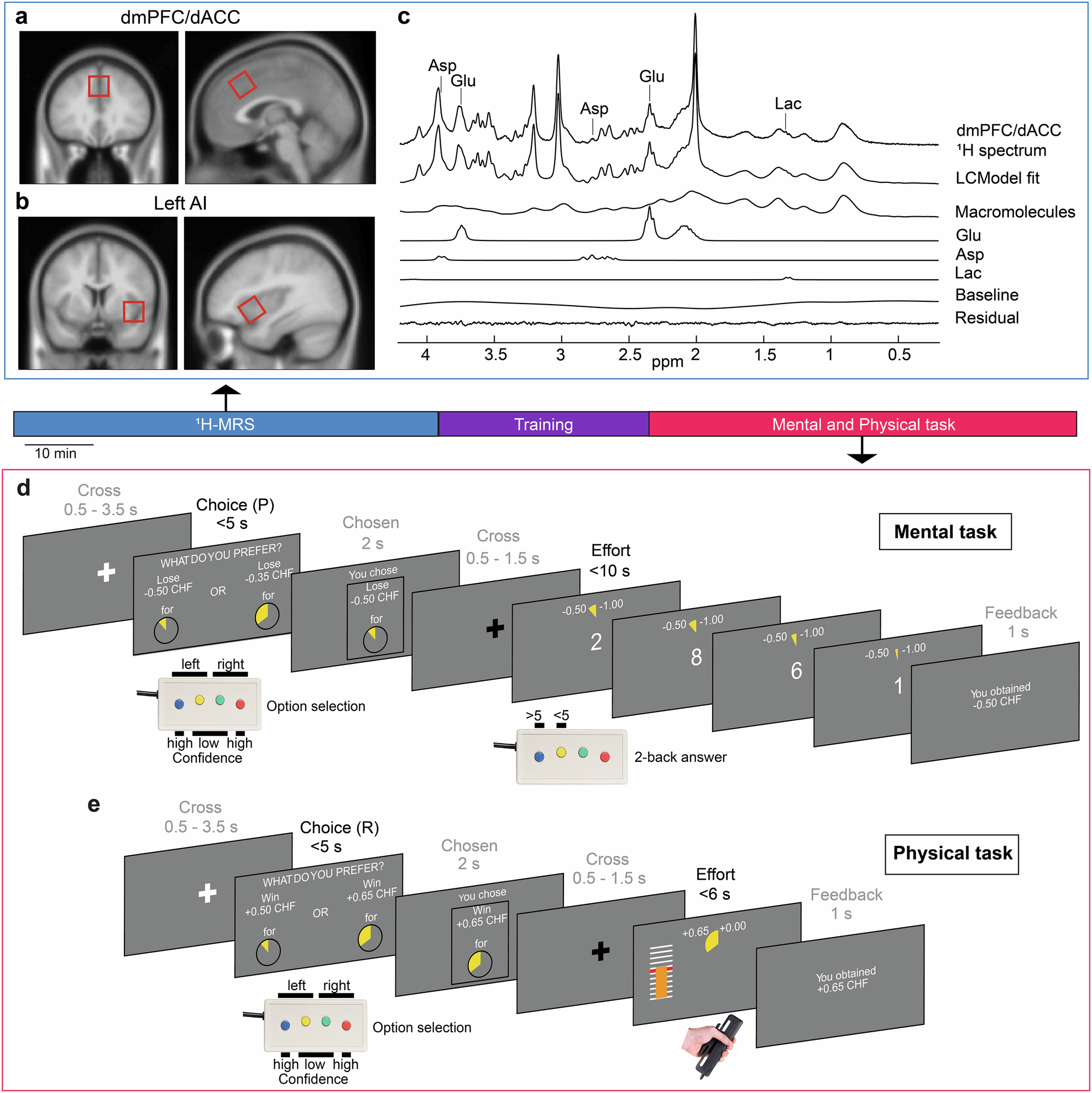 Neurometabolic predictors of mental effort in the frontal cortex |  Translational Psychiatry
