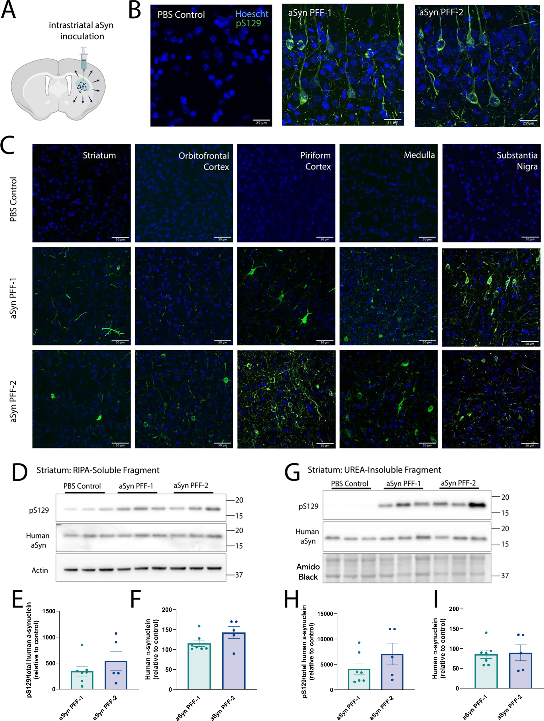 Fig. 3: Propagation of aggregated α-synuclein following inoculation of pre-formed fibrils in vivo.