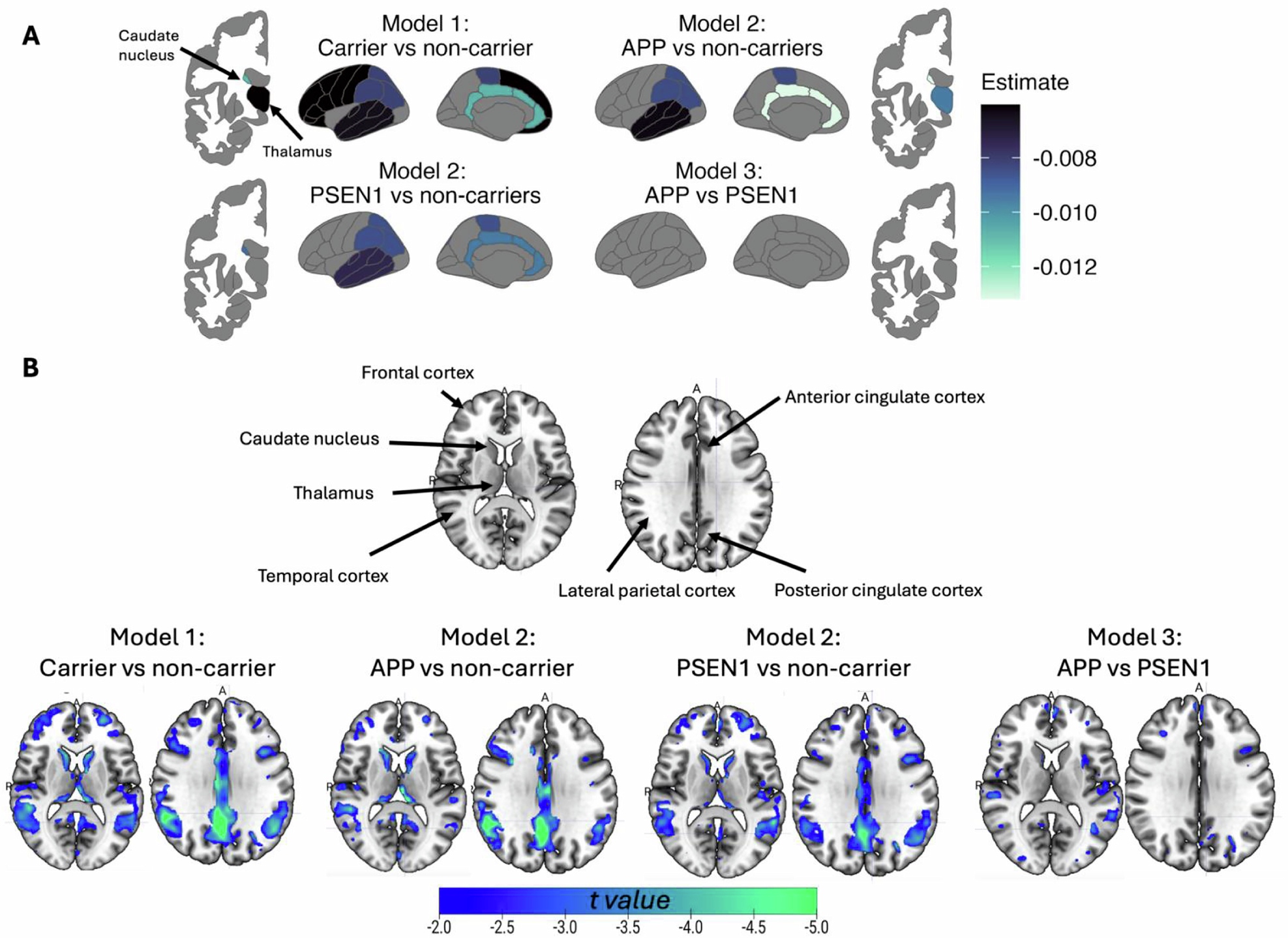 遺伝子変異の種類がアルツハイマー病初期進行を左右することを解明 (Mutation type shapes early Alzheimer’s)