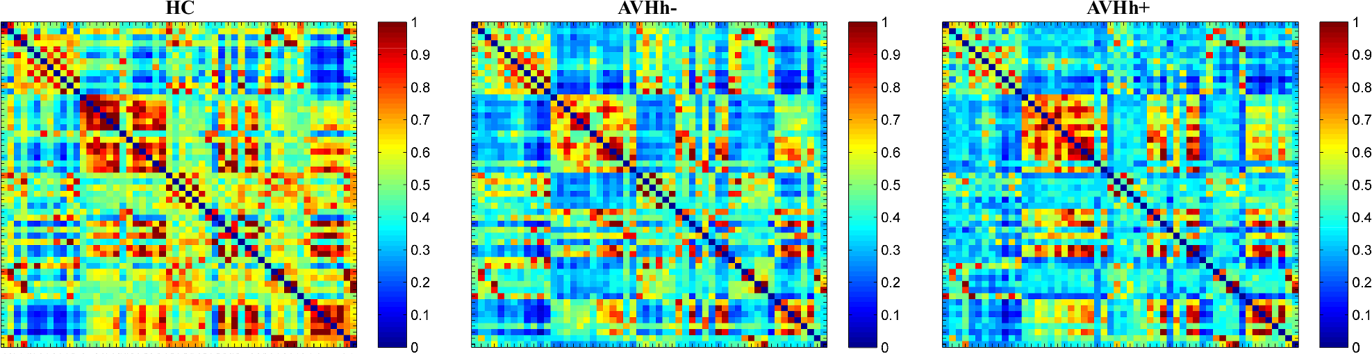 Fig. 2: FC matrices derived from fNIRS data across three groups (from left to right: HCs, AVHh- and AVHh+, respectively).