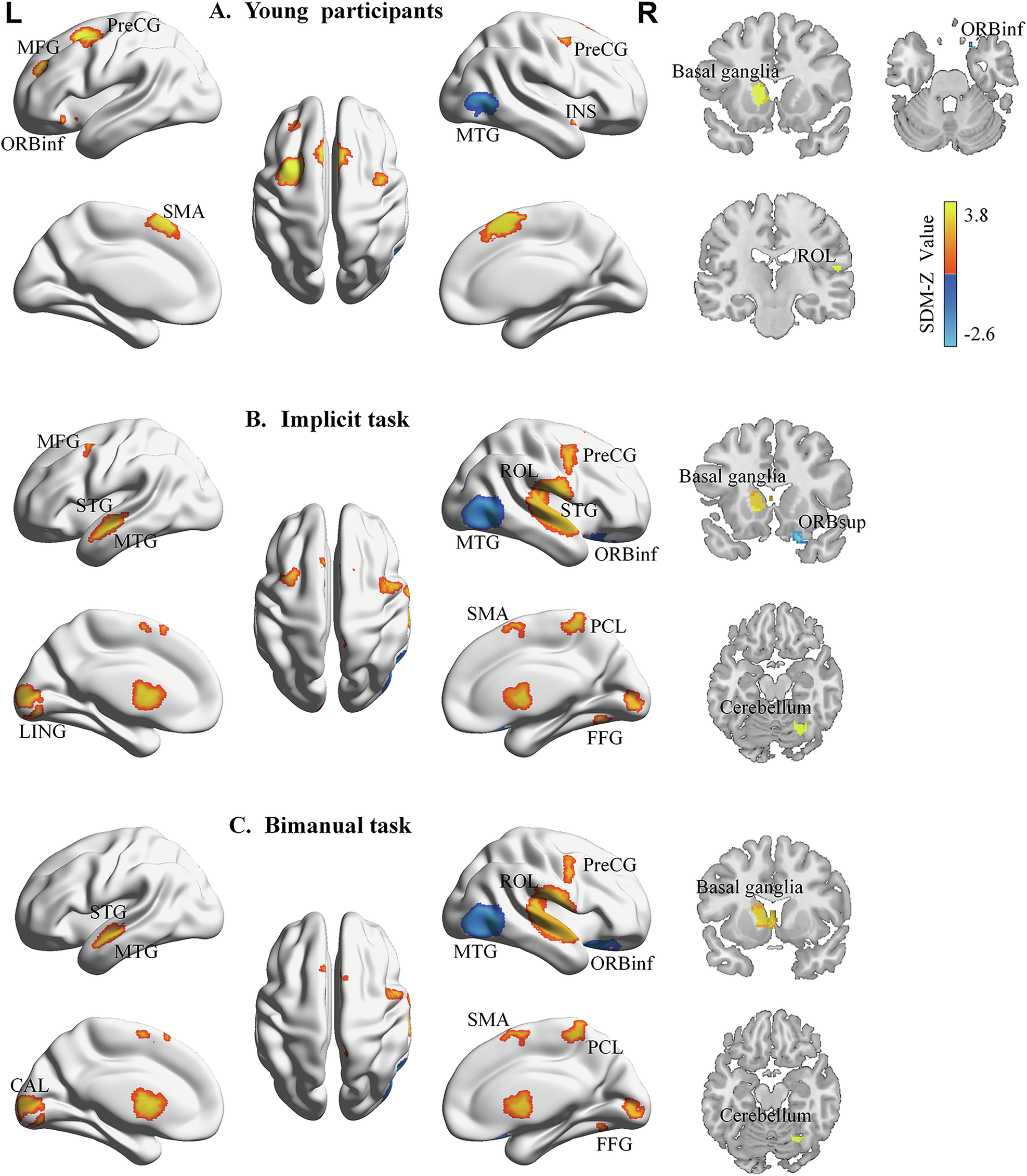 Fig. 3: Results of subgroup analyses showing brain activation associated with the contrast between sequential and random conditions.