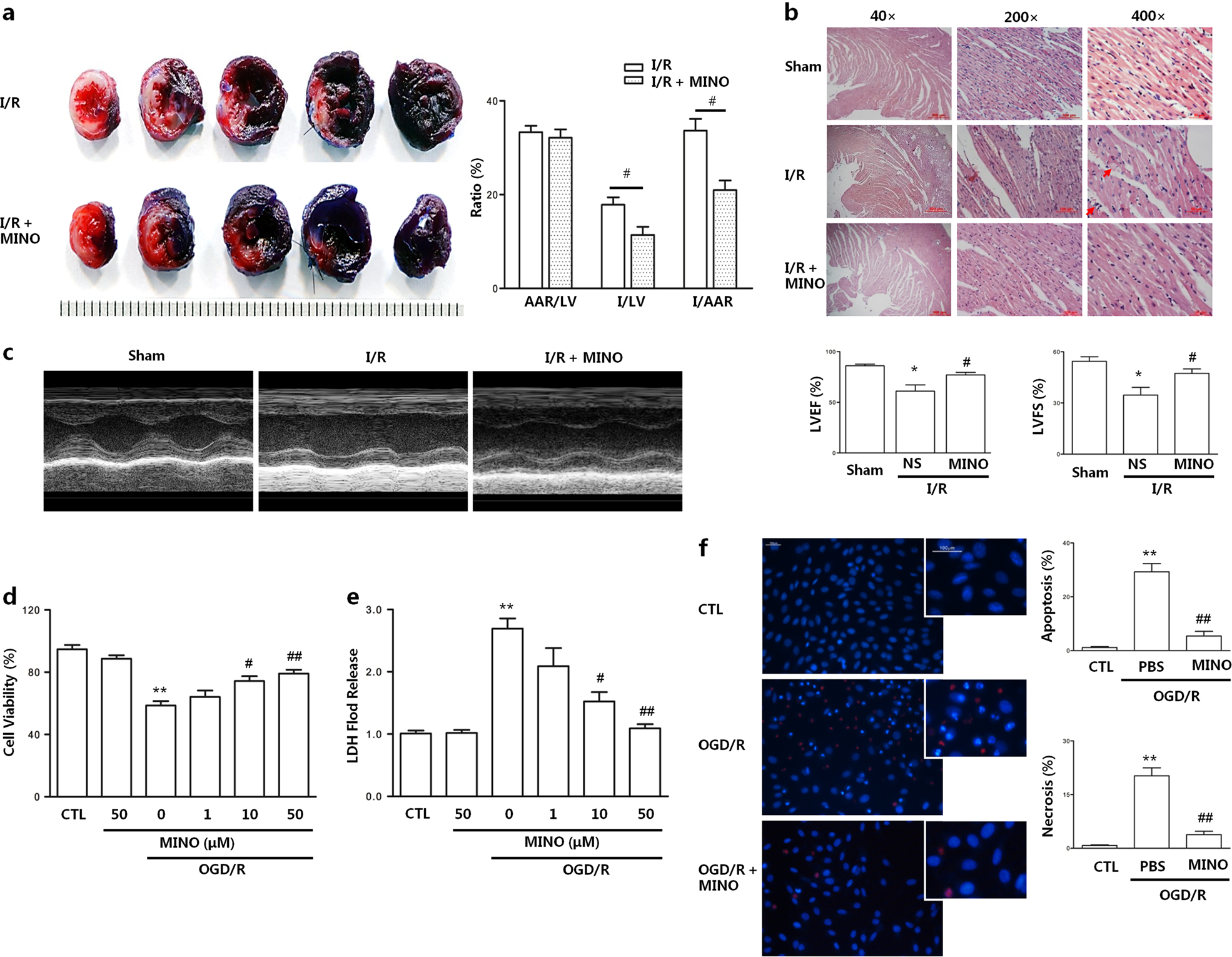 Minocycline protects against myocardial ischemia/reperfusion injury in rats  by upregulating MCPIP1 to inhibit NF-κB activation | Acta Pharmacologica  Sinica