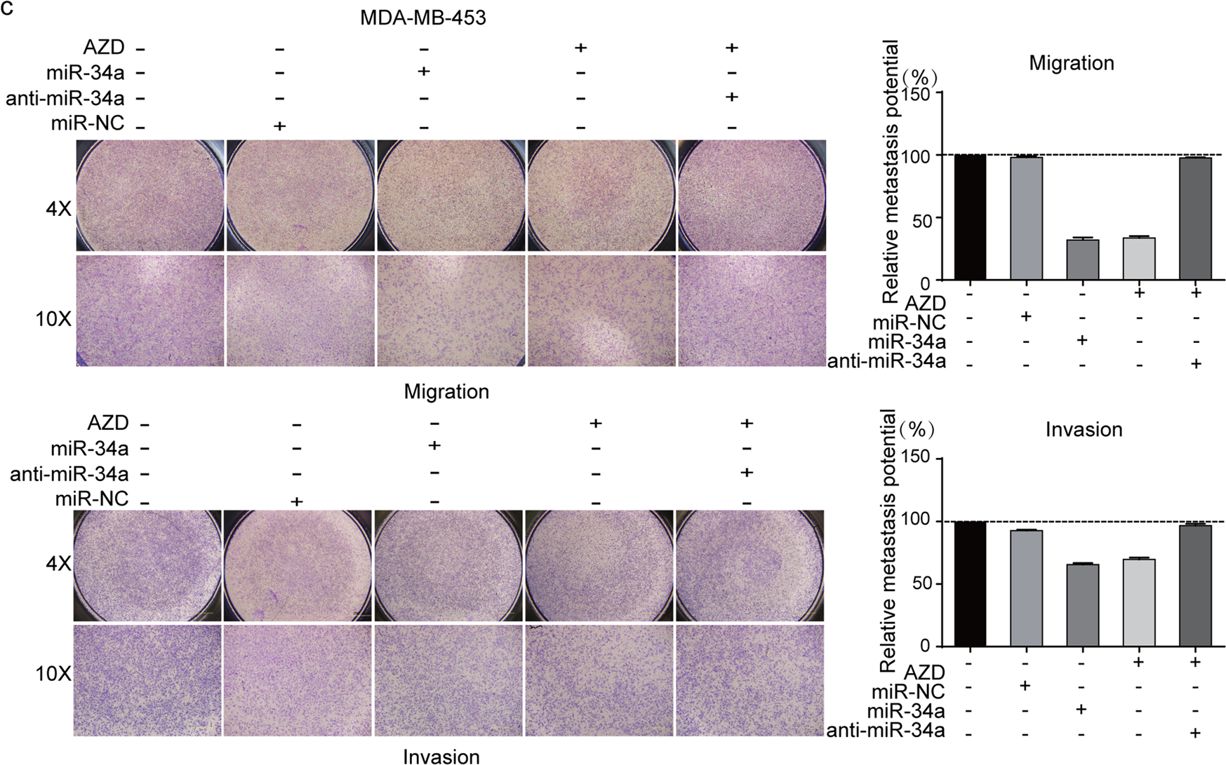 Fig. 5: The influences of AZD9291 and miR-34a on cancer cell metastasis.