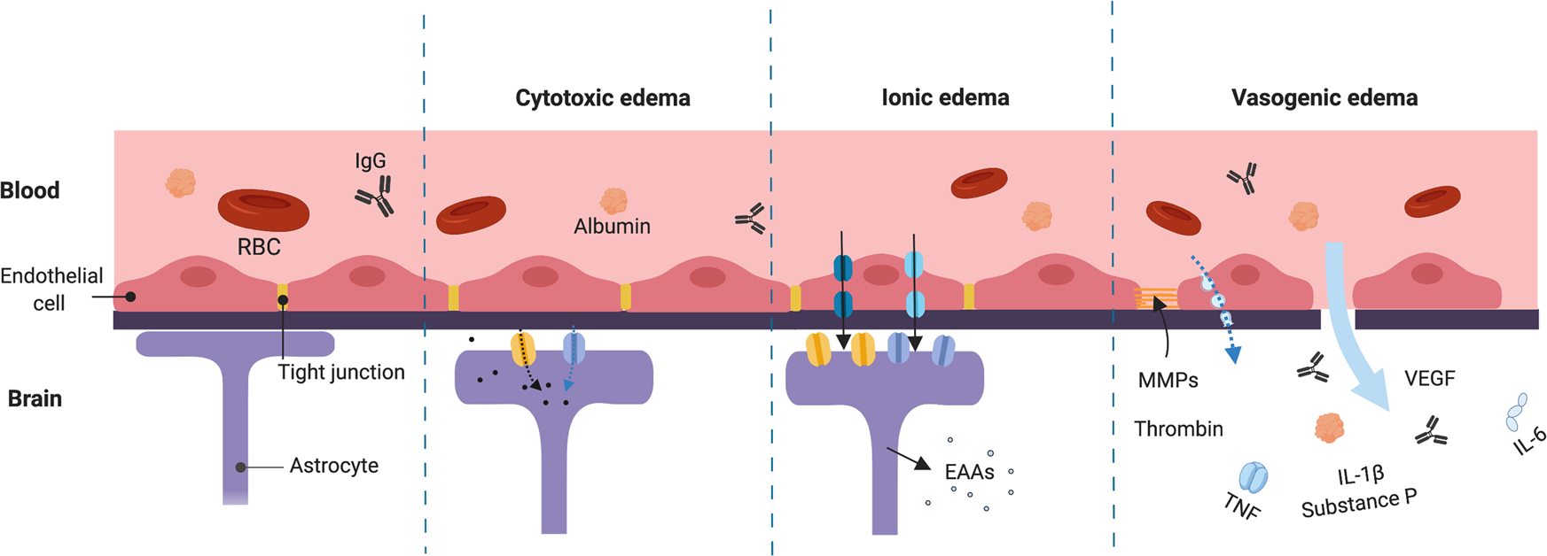 Drug development in targeting ion channels for brain edema | Acta  Pharmacologica Sinica