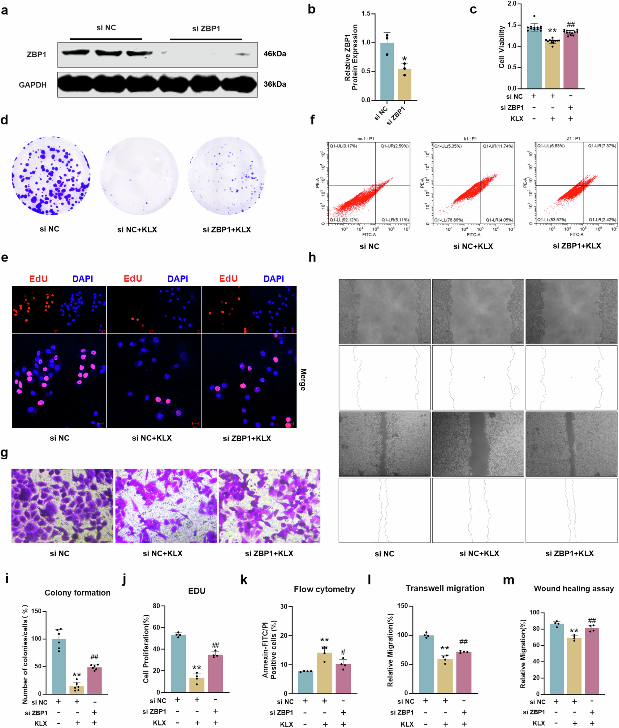 Fig. 6: ZBP1 knockdown reversed the effect of KLX on HepG2 cells.