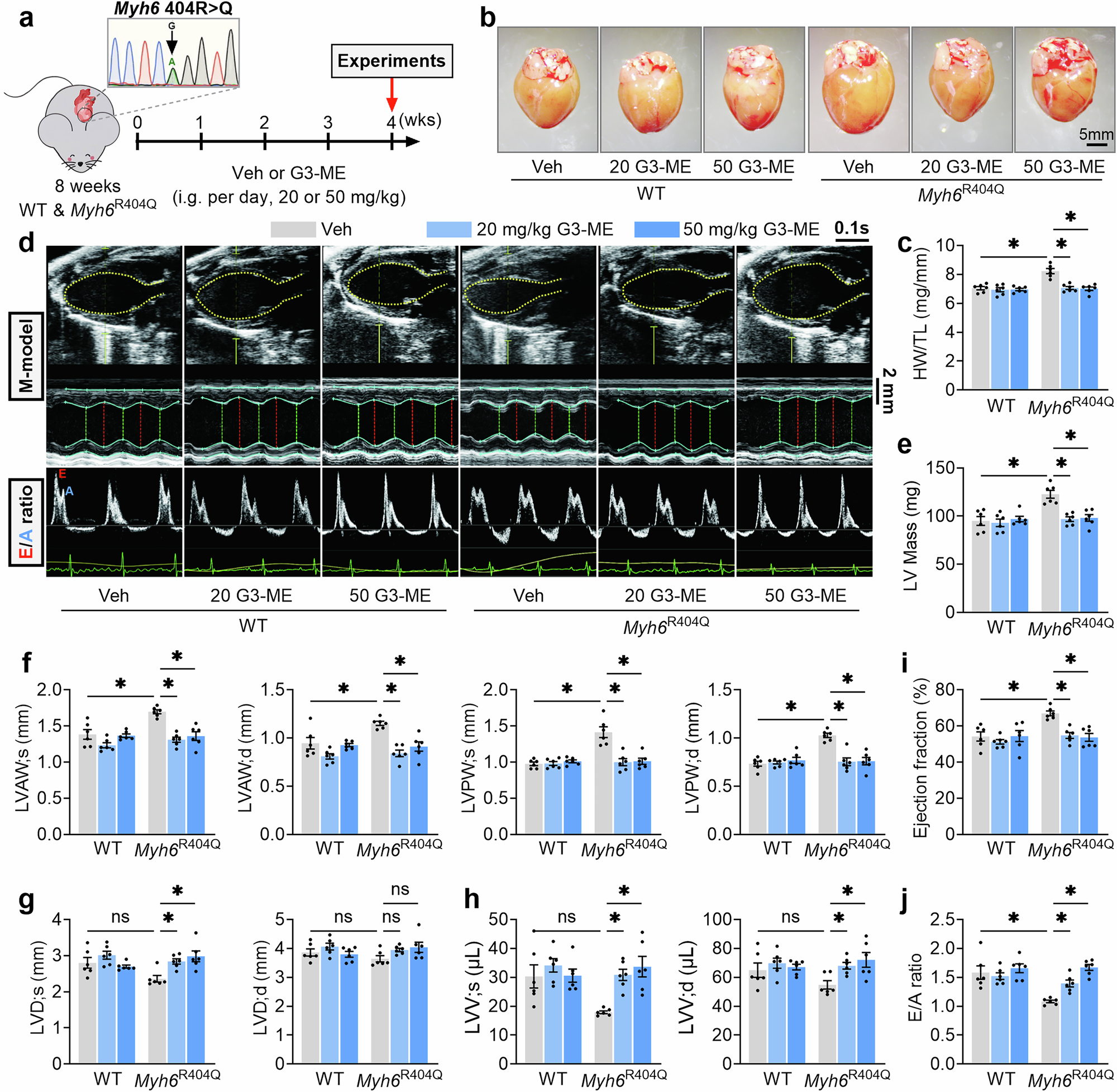 Fig. 3: Galangin 3-methyl ether (G3-ME) supplementation restores both cardiac systolic and diastolic function in Myh6R404Q mice with pathological cardiac hypertrophy.