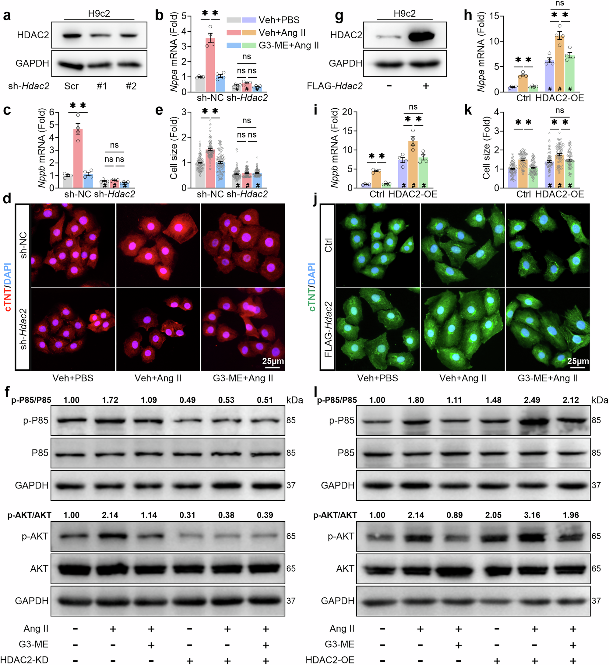 Fig. 8: Interference with HDAC2 expression influences the cardioprotective effect of galangin 3-methyl ether (G3-ME) on PI3K-AKT signaling and cardiac hypertrophy.