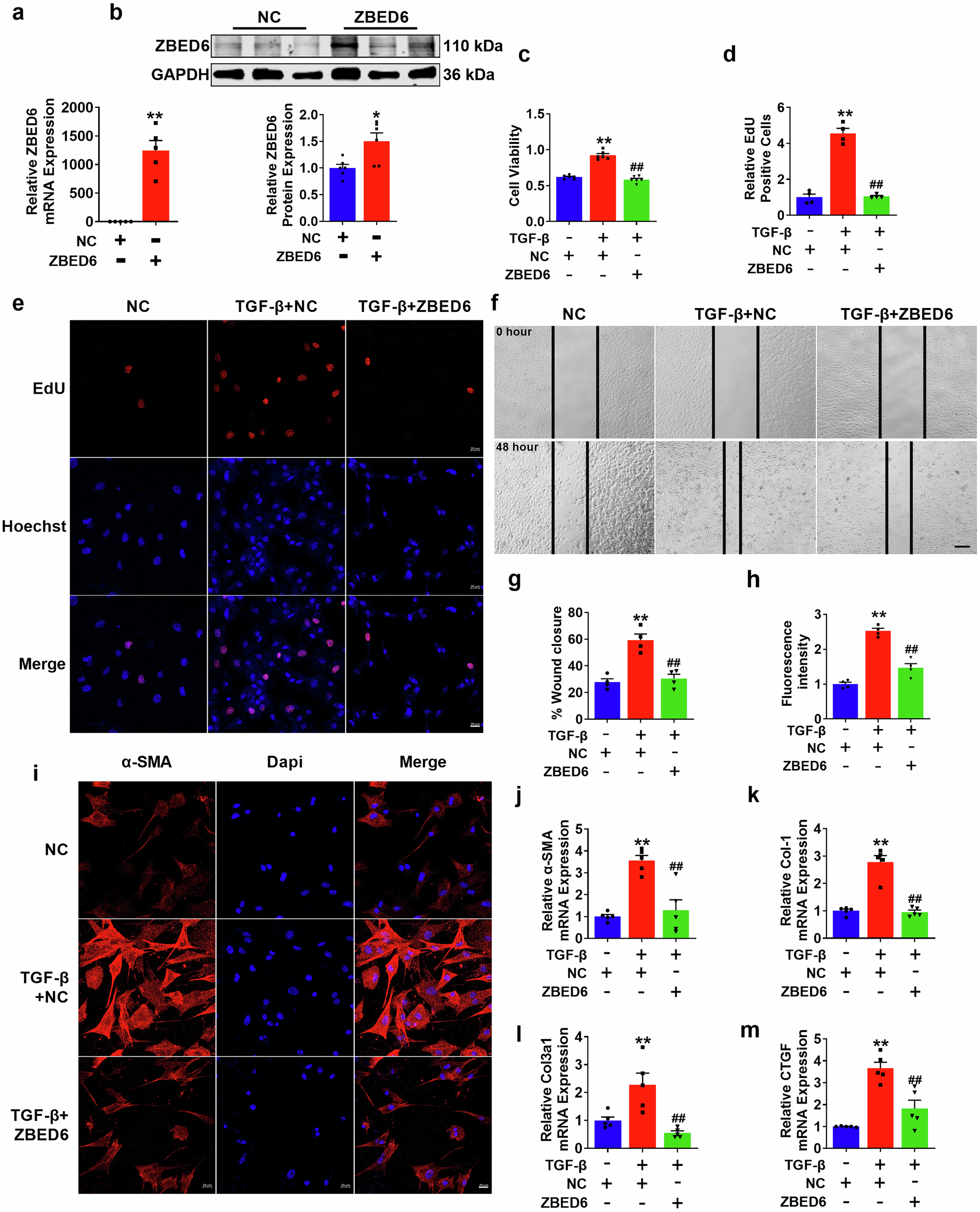 Fig. 4: ZBED6 overexpression prevents PMCFs activation induced by TGF-β in vitro.