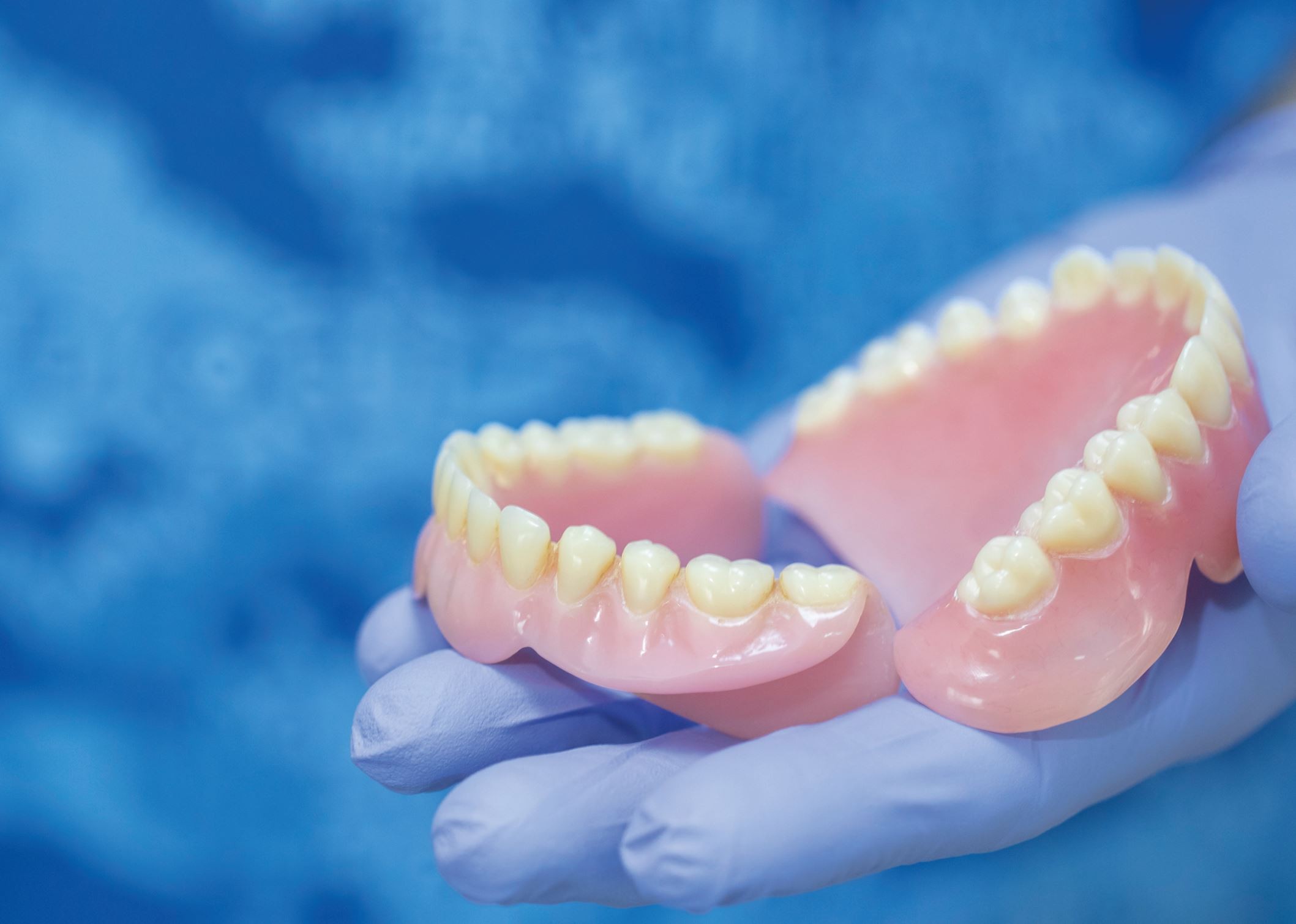 Аллон 4 протезирование. Замки бредент для бюгельного протеза. Мостовидный протез 4 зуба на 2 имплантах. Аттачменты бюгельного протеза. Микропротез квадротти.