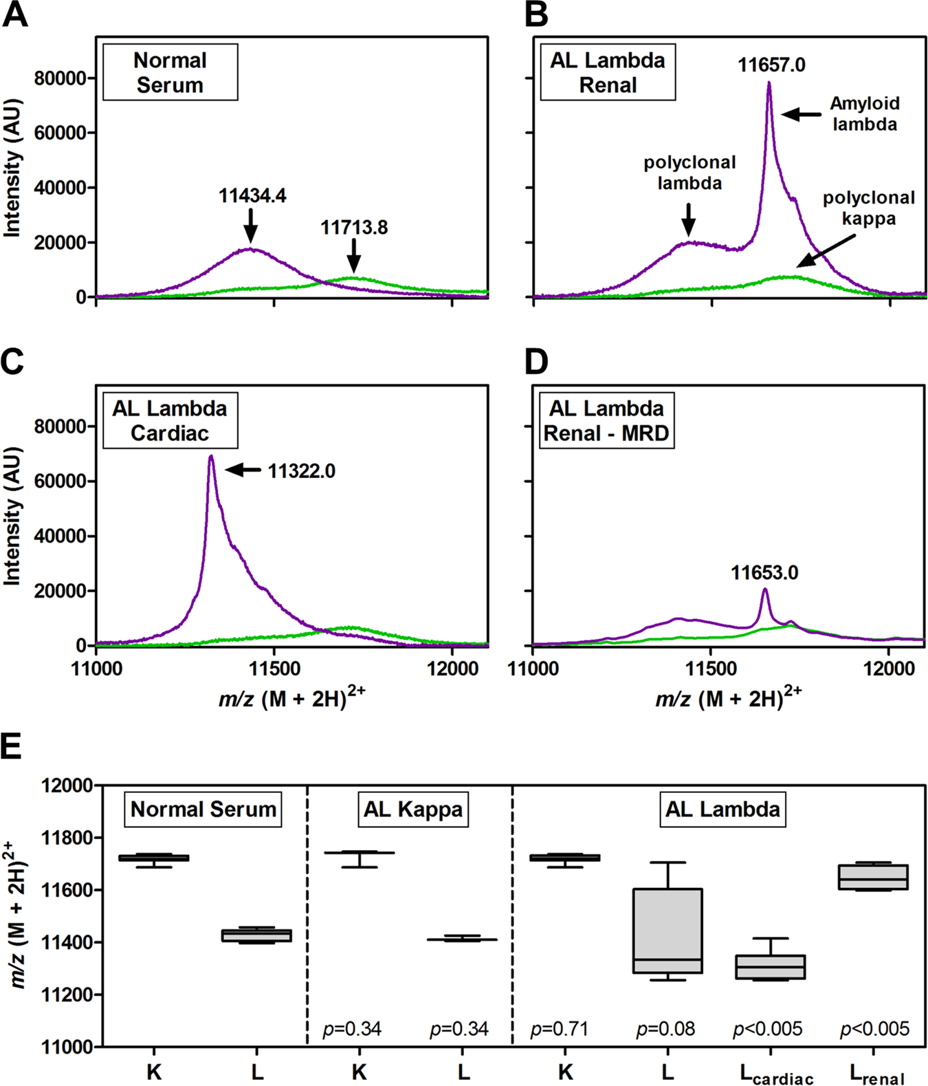 A novel mass spectrometry method to identify the serum monoclonal light  chain component in systemic light chain amyloidosis | Blood Cancer Journal