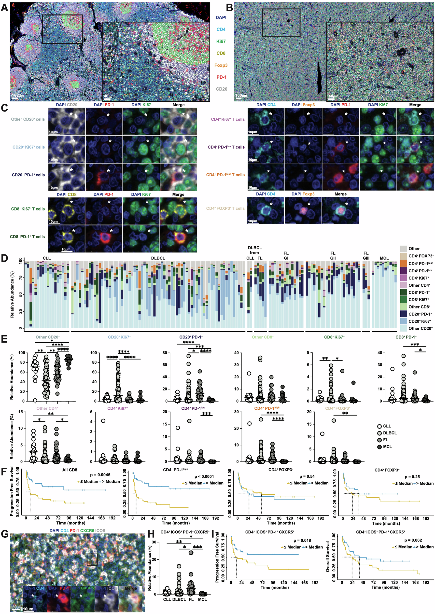 Fig. 1: CD8+ T-cells and CD4+CXCR5+PD1hi T-follicular helper cells are overrepresented and positively prognostic in DLBCL.