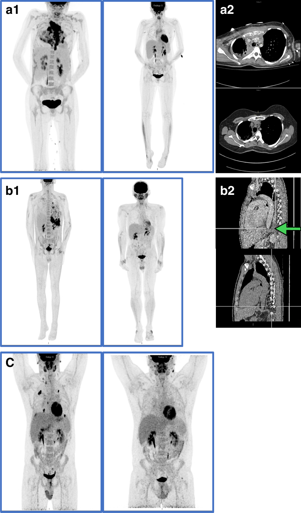 Fig. 1: Representative radiology (left to right).